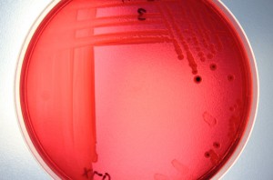 Microbiology Services Analyses Water Cooling Towers Legionella